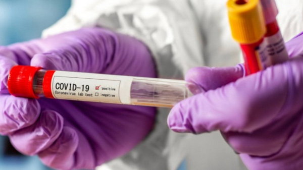 В России выявили коронавирус у еще одного вакцинированного медика