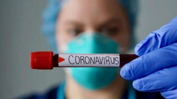 В Украине 265 новых случаев COVID-19 за день